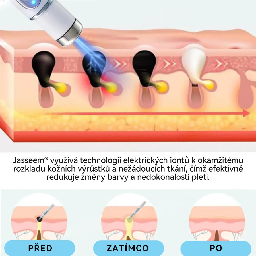 𝐉𝐚𝐬𝐬𝐞𝐞𝐦® Laserové pero lékařské kvality 💕 (Poháněno technologií CO₂ laseru – účinně odstraňuje znaménka, bradavice, kožní výrůstky, pigmentové skvrny a další nedokonalosti pleti) 🔥