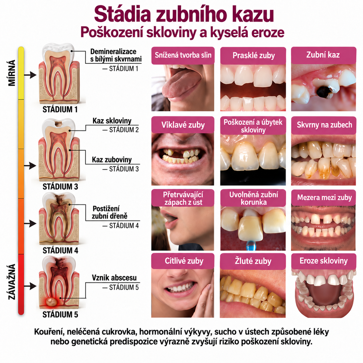Keyess® DenPerm🎉🧣🧣 — Gel pro péči o zubní sklovinu při kazech, citlivých zubech a oslabené sklovině
