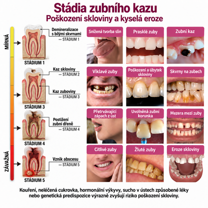 Keyess® DenPerm🎉🧣🧣 — Gel pro péči o zubní sklovinu při kazech, citlivých zubech a oslabené sklovině