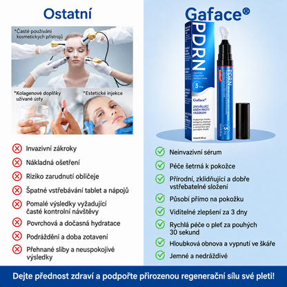 𝑮𝒂𝒇𝒂𝒄𝒆® 👨‍⚕️✨𝑃𝐷𝑅𝑁 𝑍𝑃𝐸𝑉Ň𝑈𝐽Í𝐶Í 𝐾𝑅É𝑀 𝑃𝑅𝑂𝑇𝐼 𝑉𝑅Á𝑆𝐾Á𝑀