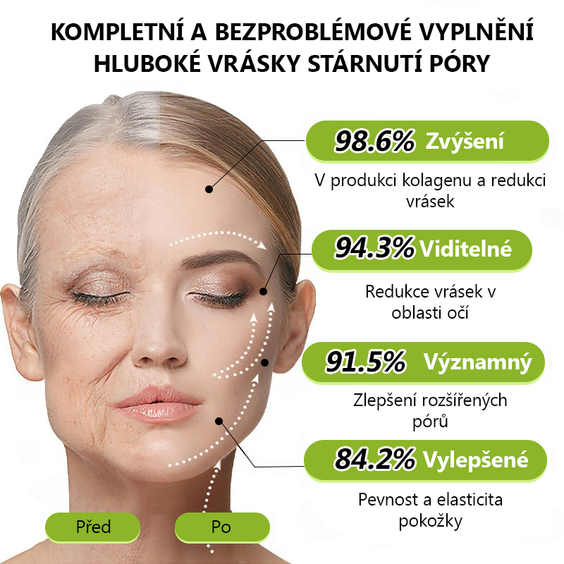（👩🏻‍⚕️SPECIÁLNÍ VÝPRODEJ POSLEDNÍ DEN - SLEVA 50 %🔥)🤩👏𝐺𝑙𝑖𝑚𝑚𝑒𝑟𝑙𝑦® 𝐵𝑂𝑇𝑂𝑋 & 𝑉𝐼𝑇𝐴𝑀𝐼𝑁 𝐴 𝐿𝑁𝐽𝐸𝐾𝐶𝐸 𝑅𝐸𝑇𝐼𝑁𝑂𝐿𝑈 𝑍𝑝𝑒𝑣ň𝑢𝑗í𝑐í 𝑃𝑟𝑜𝑡𝑖 𝑉𝑟á𝑠𝑘á𝑚 𝐾𝑟é𝑚
