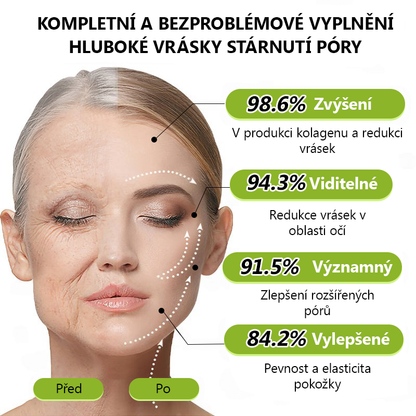 𝑶𝒇𝒊𝒄𝒊á𝒍𝒏í 𝒐𝒃𝒄𝒉𝒐𝒅 👩‍⚕️🎁｜𝒁í𝒔𝒌𝒆𝒋𝒕𝒆 𝒛𝒑ě𝒕 𝒎𝒍𝒂𝒅𝒊𝒔𝒕𝒗𝒐𝒖 𝒑𝒍𝒆ť 𝒉𝒏𝒆𝒅 𝒕𝒆ď💫𝑺𝑻𝑫𝑬𝑰® 𝑩𝑶𝑻𝑶𝑿 & 𝑽𝑰𝑻𝑨𝑴𝑰𝑵 𝑨 𝑹𝑬𝑻𝑰𝑵𝑶𝑳 𝑳𝒊𝒇𝒕𝒊𝒏𝒈𝒐𝒗ý 𝒂 𝒛𝒑𝒆𝒗ň𝒖𝒋í𝒄í 𝒌𝒓é𝒎 𝒑𝒓𝒐𝒕𝒊 𝒗𝒓á𝒔𝒌á𝒎