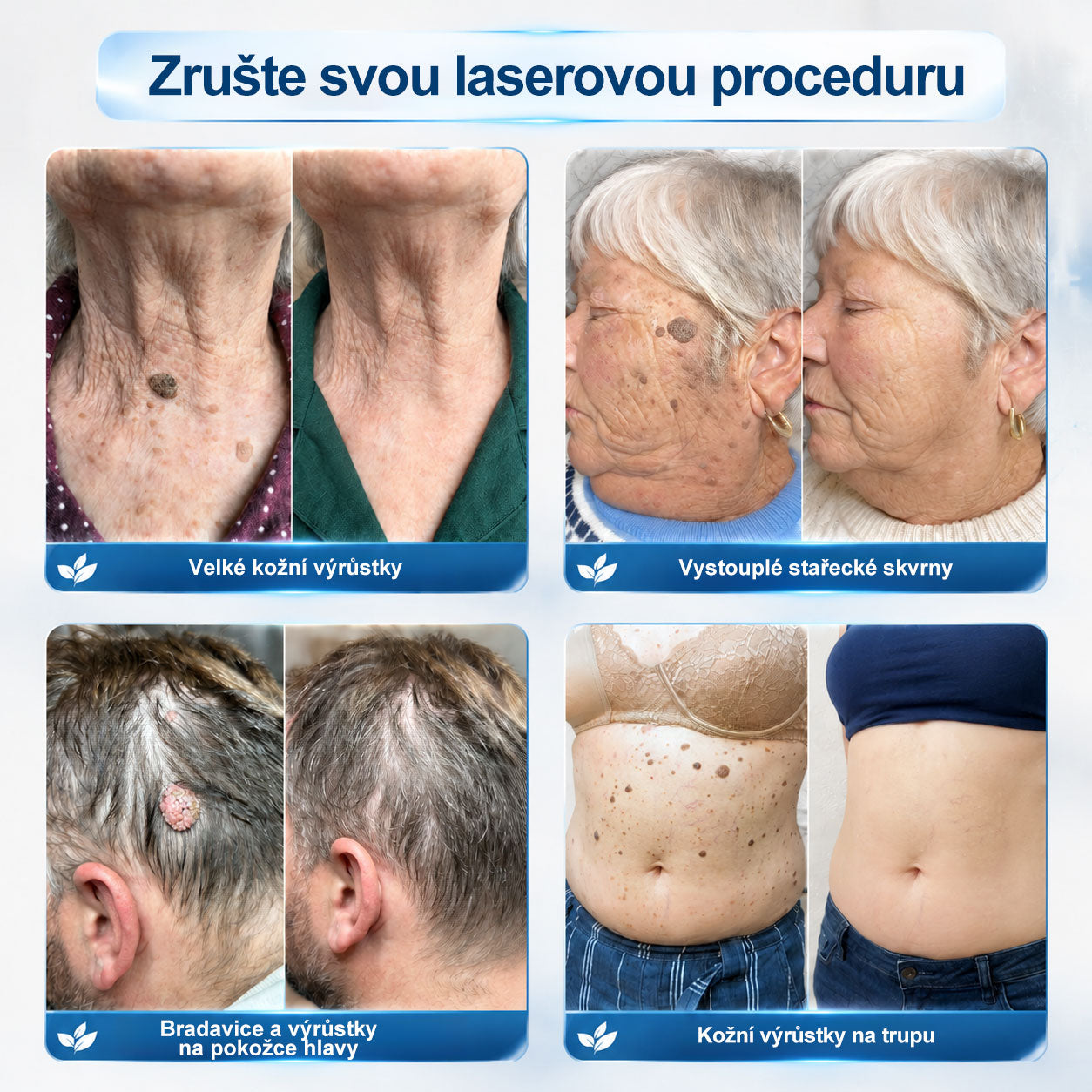 🦊🦊Oficiální značkový obchod |🖊️𝐏𝐢𝐜𝑑𝑜® 𝟩𝖽𝖾𝗻𝗻í 𝘰𝘥𝘴𝘵𝗋𝖺ň𝗈𝗏𝖺č 𝒔𝒌𝒗𝒓𝙣 𝙖 𝙥𝙞𝙜𝙢𝙚𝙣𝙩𝘰𝘷ý𝘤𝘩 𝘴𝘬𝖛𝖗𝖓 (Bezbolestný rollerball bez jizev)🎄
