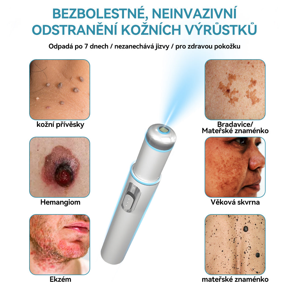 𝐉𝐚𝐬𝐬𝐞𝐞𝐦® Laserové pero lékařské kvality 💕 (Poháněno technologií CO₂ laseru – účinně odstraňuje znaménka, bradavice, kožní výrůstky, pigmentové skvrny a další nedokonalosti pleti) 🔥