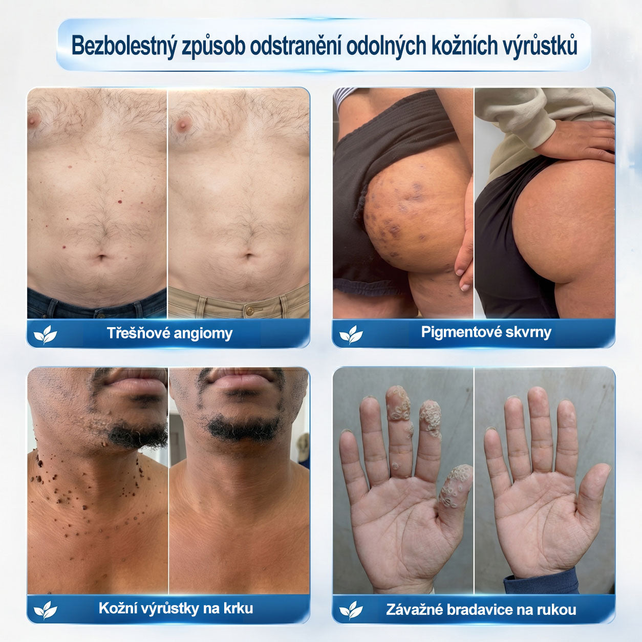 🦊🦊Oficiální značkový obchod |🖊️𝐏𝐢𝐜𝑑𝑜® 𝟩𝖽𝖾𝗻𝗻í 𝘰𝘥𝘴𝘵𝗋𝖺ň𝗈𝗏𝖺č 𝒔𝒌𝒗𝒓𝙣 𝙖 𝙥𝙞𝙜𝙢𝙚𝙣𝙩𝘰𝘷ý𝘤𝘩 𝘴𝘬𝖛𝖗𝖓 (Bezbolestný rollerball bez jizev)🎄