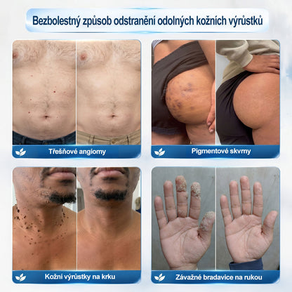 🦊🦊Oficiální značkový obchod |🖊️𝐏𝐢𝐜𝑑𝑜® 𝟩𝖽𝖾𝗻𝗻í 𝘰𝘥𝘴𝘵𝗋𝖺ň𝗈𝗏𝖺č 𝒔𝒌𝒗𝒓𝙣 𝙖 𝙥𝙞𝙜𝙢𝙚𝙣𝙩𝘰𝘷ý𝘤𝘩 𝘴𝘬𝖛𝖗𝖓 (Bezbolestný rollerball bez jizev)🎄
