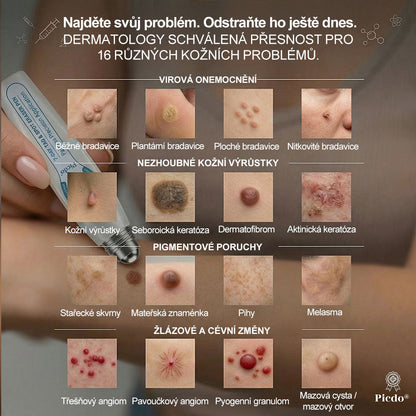 🦊🦊Oficiální značkový obchod |🖊️𝐏𝐢𝐜𝑑𝑜® 𝟩𝖽𝖾𝗻𝗻í 𝘰𝘥𝘴𝘵𝗋𝖺ň𝗈𝗏𝖺č 𝒔𝒌𝒗𝒓𝙣 𝙖 𝙥𝙞𝙜𝙢𝙚𝙣𝙩𝘰𝘷ý𝘤𝘩 𝘴𝘬𝖛𝖗𝖓 (Bezbolestný rollerball bez jizev)🎄