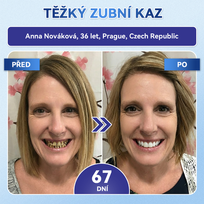 🌟🪥𝑶𝒇𝒊𝒄𝒊á𝒍𝒏í 𝒐𝒃𝒄𝒉𝒐𝒅|𝐺𝑙𝑖𝑚𝑚𝑒𝑟𝑙𝑦®🦷🦷 𝑇𝑖𝑑𝑒𝑔𝑙𝑢𝑠𝑖𝑏 𝑍𝑢𝑏𝑦 & 𝐷á𝑠𝑛ě 𝑂𝑏𝑛𝑜𝑣𝑎 𝐼𝑛𝑠𝑡𝑎𝑛𝑡𝑛í Ú𝑠𝑡𝑛í 𝑑𝑢𝑡𝑖𝑛𝑎 𝑁á𝑝𝑙𝑎𝑠𝑡
