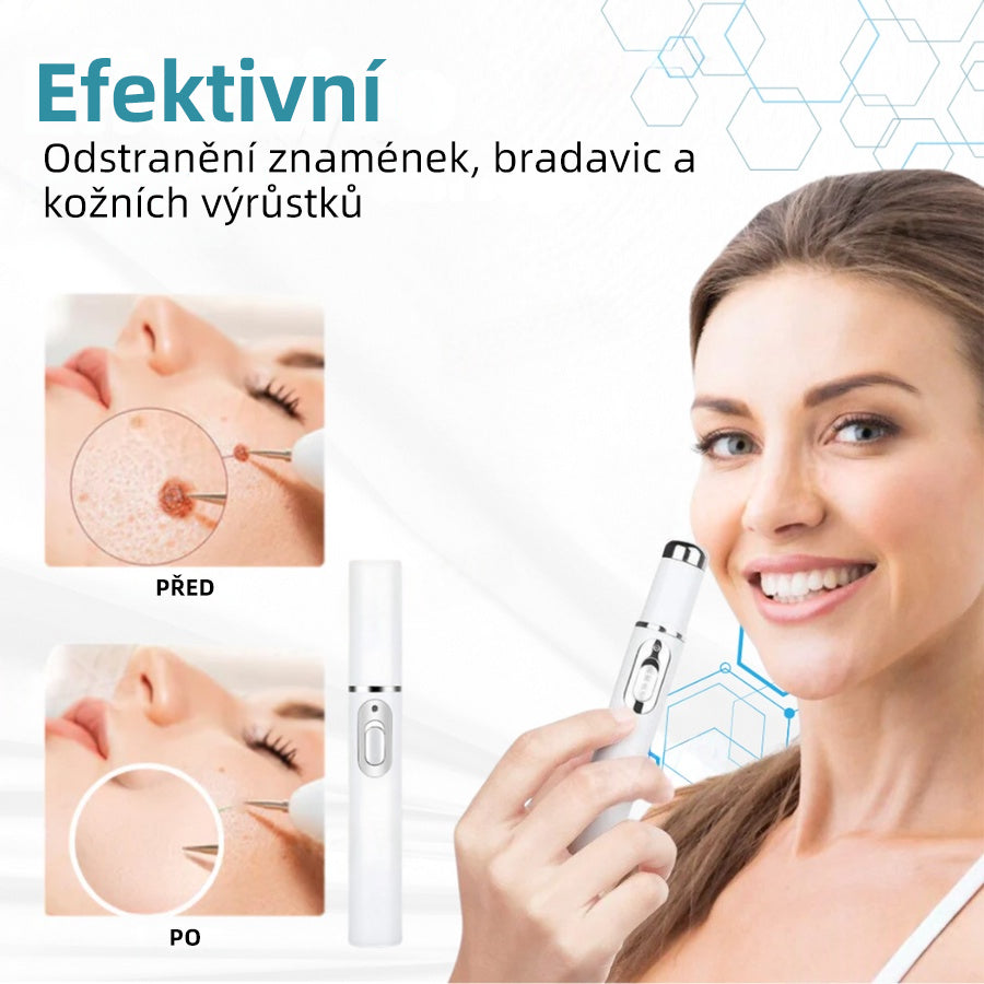 𝐉𝐚𝐬𝐬𝐞𝐞𝐦® Laserové pero lékařské kvality 💕 (Poháněno technologií CO₂ laseru – účinně odstraňuje znaménka, bradavice, kožní výrůstky, pigmentové skvrny a další nedokonalosti pleti) 🔥