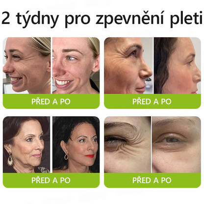 𝑶𝒇𝒊𝒄𝒊á𝒍𝒏í 𝒐𝒃𝒄𝒉𝒐𝒅 👩‍⚕️🎁｜𝒁í𝒔𝒌𝒆𝒋𝒕𝒆 𝒛𝒑ě𝒕 𝒎𝒍𝒂𝒅𝒊𝒔𝒕𝒗𝒐𝒖 𝒑𝒍𝒆ť 𝒉𝒏𝒆𝒅 𝒕𝒆ď💫𝑺𝑻𝑫𝑬𝑰® 𝑩𝑶𝑻𝑶𝑿 & 𝑽𝑰𝑻𝑨𝑴𝑰𝑵 𝑨 𝑹𝑬𝑻𝑰𝑵𝑶𝑳 𝑳𝒊𝒇𝒕𝒊𝒏𝒈𝒐𝒗ý 𝒂 𝒛𝒑𝒆𝒗ň𝒖𝒋í𝒄í 𝒌𝒓é𝒎 𝒑𝒓𝒐𝒕𝒊 𝒗𝒓á𝒔𝒌á𝒎