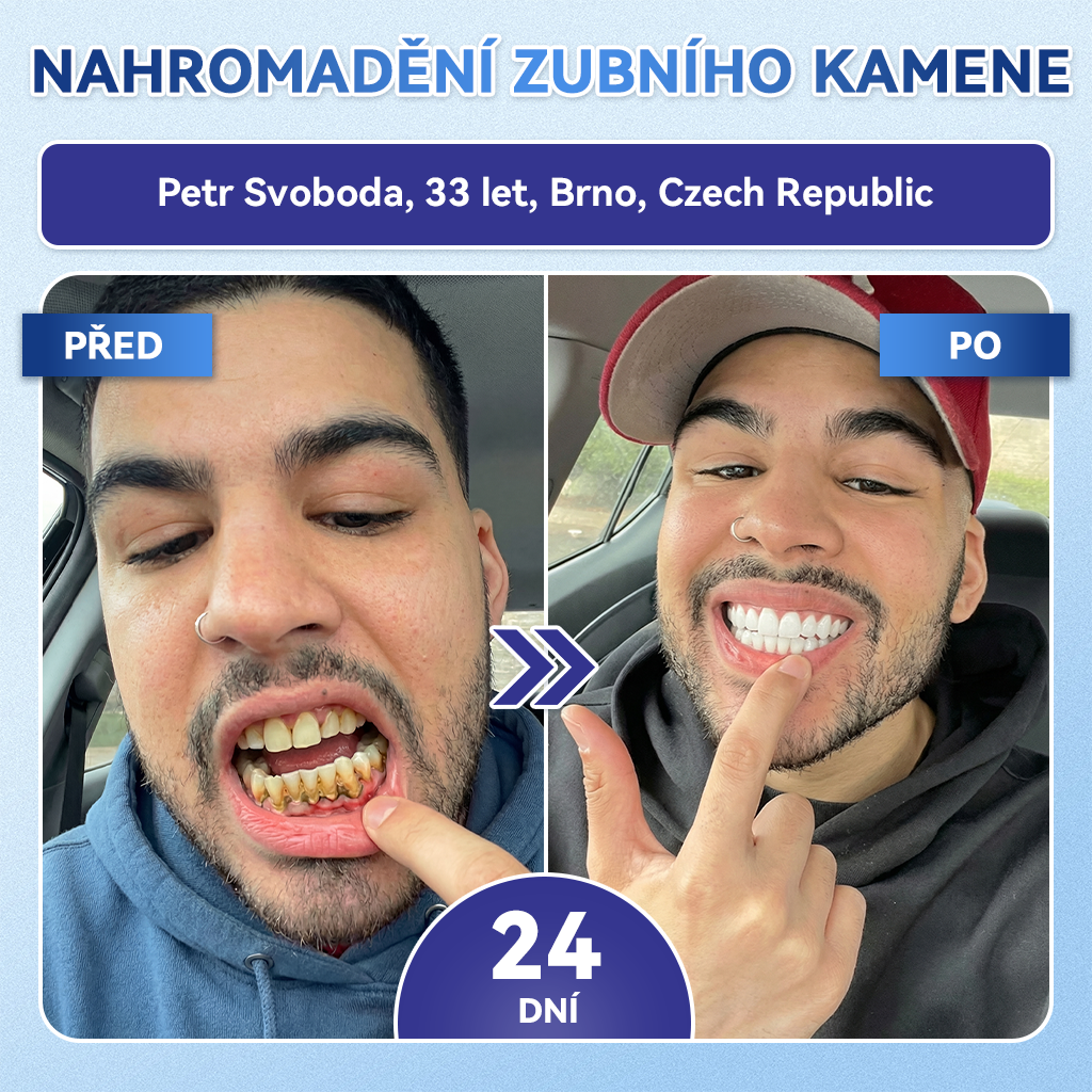 🌟🪥𝑶𝒇𝒊𝒄𝒊á𝒍𝒏í 𝒐𝒃𝒄𝒉𝒐𝒅|𝐺𝑙𝑖𝑚𝑚𝑒𝑟𝑙𝑦®🦷🦷 𝑇𝑖𝑑𝑒𝑔𝑙𝑢𝑠𝑖𝑏 𝑍𝑢𝑏𝑦 & 𝐷á𝑠𝑛ě 𝑂𝑏𝑛𝑜𝑣𝑎 𝐼𝑛𝑠𝑡𝑎𝑛𝑡𝑛í Ú𝑠𝑡𝑛í 𝑑𝑢𝑡𝑖𝑛𝑎 𝑁á𝑝𝑙𝑎𝑠𝑡