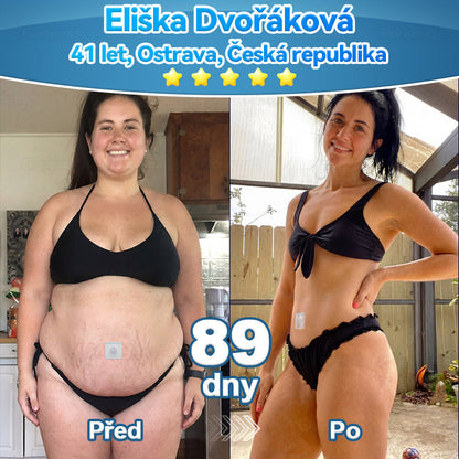 𝑭𝒍𝒐𝒓𝒊𝒔𝒎𝒂® 💎💎 𝑬𝒙𝒕𝒓𝒂𝒌𝒕 𝒁 𝑹𝒐𝒔𝒕𝒍𝒊𝒏 𝑩𝒖ň𝒌𝒂 𝑷𝒐𝒅𝒑𝒐𝒓𝒂 𝑲𝒐𝒎𝒑𝒐𝒛𝒊𝒕 𝑵á𝒍𝒆𝒑𝒌𝒂（𝑍𝑙𝑒𝑝š𝑒𝑛í 𝑙𝑦𝑚𝑓𝑎𝑡𝑖𝑐𝑘é 𝑑𝑟𝑒𝑛áž𝑒 𝑎 𝑠𝑛íž𝑒𝑛í 𝑡ě𝑙𝑒𝑠𝑛é ℎ𝑚𝑜𝑡𝑛𝑜𝑠𝑡𝑖）