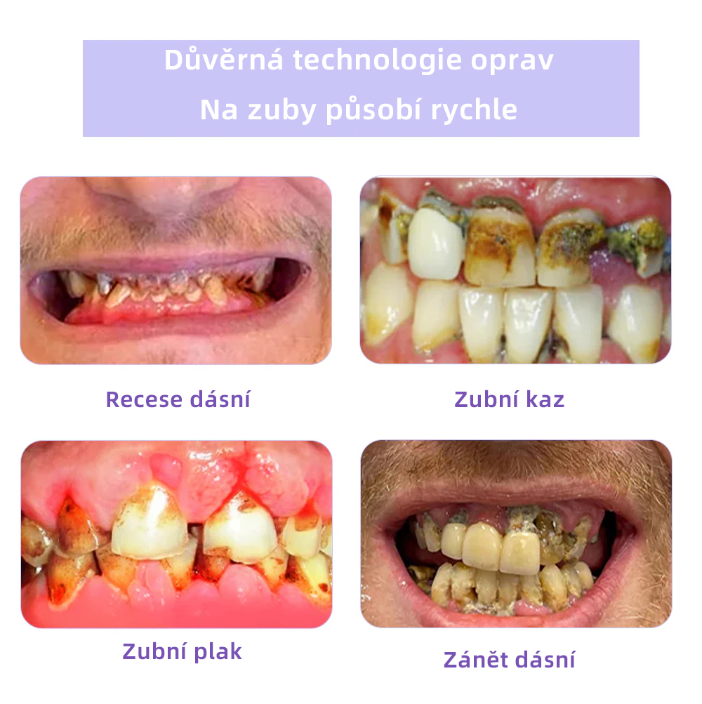 [✅Oficiální obchod.]𝐎𝐲𝐢𝐤𝐞𝐲™ Prášek na obnovu zubní minerálů 💥💥 – produkt pro péči o ústní dutinu (doporučeno odborníky České stomatologické komory, ČSK).