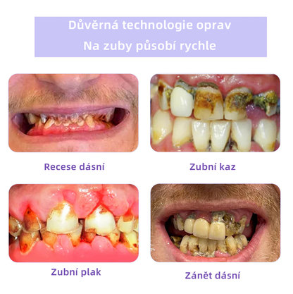 [✅Oficiální obchod.]𝐎𝐲𝐢𝐤𝐞𝐲™ Prášek na obnovu zubní minerálů 💥💥 – produkt pro péči o ústní dutinu (doporučeno odborníky České stomatologické komory, ČSK).