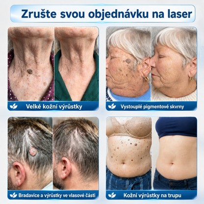 👩‍⚕️🎉 𝐎𝐟𝐢𝐜𝐢á𝐥𝐧í 𝐨𝐛𝐜𝐡𝐨𝐝 | 𝑵𝐞𝒌𝐢𝐬𝐬® 🌿 𝐌𝐢𝐤𝐫𝐨𝐣𝐞𝐡𝐥𝐨𝐯ý 𝐁𝐞𝐳𝐜𝐡𝐲𝐛𝐧á 𝐩𝐥𝐞ť 𝐊𝐨ž𝐧í š𝐭í𝐭𝐤𝐲 𝐎𝐝𝐬𝐭𝐫𝐚𝐧ě𝐧í 𝐍á𝐩𝐥𝐚𝐬𝐭 (𝐏𝐫𝐨 𝐤𝐨ž𝐧í š𝐭í𝐭𝐤𝐲, 𝐝𝐫𝐨𝐛𝐧é 𝐤𝐨ž𝐧í 𝐯ý𝐫ů𝐬𝐭𝐤𝐲, 𝐛𝐫𝐚𝐝𝐚𝐯𝐢𝐜𝐞, 𝐳𝐧𝐚𝐦é𝐧𝐤𝐚, 𝐬𝐭𝐚ř𝐞𝐜𝐤é 𝐬𝐤𝐯𝐫𝐧𝐲 𝐚 𝐩𝐢𝐠𝐦𝐞𝐧𝐭𝐨𝐯é 𝐩𝐫𝐨𝐛𝐥é𝐦𝐲