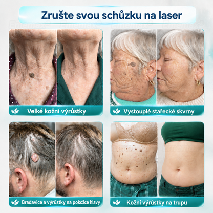 𝐄𝐦𝐞𝐦𝐚𝐱®🌵🌵2 𝑽 1 𝑴𝒊𝒌𝒓𝒐𝒋𝒆𝒉𝒍𝒊č𝒌𝒐𝒗á & 𝑯𝒚𝒅𝒓𝒐𝒌𝒐𝒍𝒐𝒊𝒅𝒏í 𝑵á𝒑𝒍𝒂𝒔𝒕 𝑵𝒂 𝑶𝒅𝒔𝒕𝒓𝒂𝒏ě𝒏í 𝒁𝒏𝒂𝒎é𝒏𝒆𝒌(𝐵𝑒𝑧 𝑏𝑜𝑙𝑒𝑠𝑡𝑖, 𝑏𝑒𝑧 𝑗𝑖𝑧𝑒𝑣)