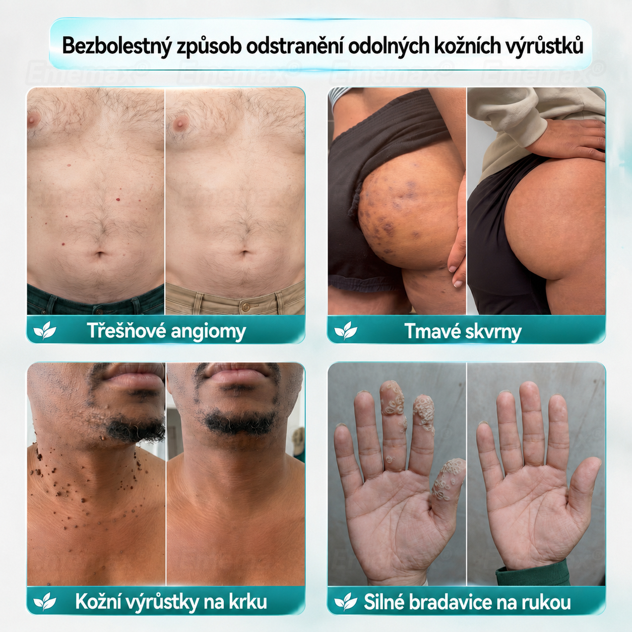 𝐄𝐦𝐞𝐦𝐚𝐱®🌵🌵2 𝑽 1 𝑴𝒊𝒌𝒓𝒐𝒋𝒆𝒉𝒍𝒊č𝒌𝒐𝒗á & 𝑯𝒚𝒅𝒓𝒐𝒌𝒐𝒍𝒐𝒊𝒅𝒏í 𝑵á𝒑𝒍𝒂𝒔𝒕 𝑵𝒂 𝑶𝒅𝒔𝒕𝒓𝒂𝒏ě𝒏í 𝒁𝒏𝒂𝒎é𝒏𝒆𝒌(𝐵𝑒𝑧 𝑏𝑜𝑙𝑒𝑠𝑡𝑖, 𝑏𝑒𝑧 𝑗𝑖𝑧𝑒𝑣)