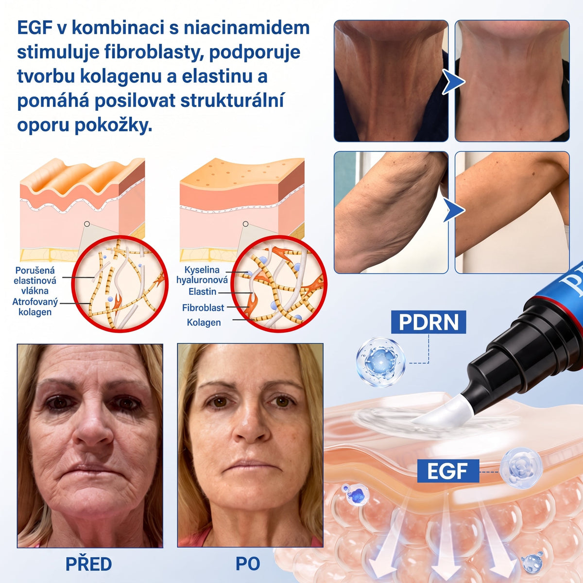 𝑮𝒂𝒇𝒂𝒄𝒆® 👨‍⚕️✨𝑃𝐷𝑅𝑁 𝑍𝑃𝐸𝑉Ň𝑈𝐽Í𝐶Í 𝐾𝑅É𝑀 𝑃𝑅𝑂𝑇𝐼 𝑉𝑅Á𝑆𝐾Á𝑀